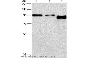 Western blot analysis of A431 and hela cell,mouse brain tissue, using PIP5K1C Polyclonal Antibody at dilution of 1:500 (PIP5K1C 抗体)