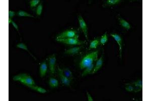 Immunofluorescence staining of Hela cells with ABIN7143574 at 1:133, counter-stained with DAPI.