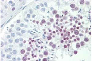 Immunohistochemistry (IHC) image for anti-Inhibitor of DNA Binding 4, Dominant Negative Helix-Loop-Helix Protein (ID4) (AA 1-50) antibody (ABIN2879393)