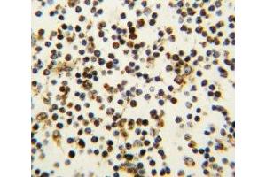 IHC analysis of FFPE human lymph tissue stained with NPM1 antibody