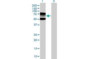 Western Blot analysis of RNF168 expression in transfected 293T cell line by RNF168 MaxPab polyclonal antibody. (RNF168 抗体  (AA 1-571))