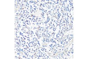 Immunohistochemistry of paraffin-embedded human tonsil using CASP3 antibody. (Caspase 3 抗体  (AA 55-160))