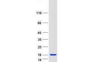 Western Blotting (WB) image for Cell Division Cycle 26 Homolog (CDC26) protein (Myc-DYKDDDDK Tag) (ABIN2713833)