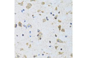 Immunohistochemistry of paraffin-embedded rat brain using PDP1 antibody (ABIN1980348) at dilution of 1:100 (40x lens). (PDP 抗体)