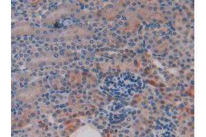 Figure. (CYR61 抗体  (AA 176-379))