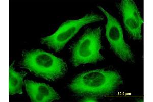 Immunofluorescence of monoclonal antibody to TUBA6 on HeLa cell. (TUBA1C 抗体  (AA 1-449))