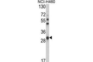 Western Blotting (WB) image for anti-Glutathione S-Transferase omega 1 (GSTO1) antibody (ABIN3001725) (GSTO1 抗体)