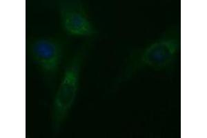 Image no. 3 for anti-Tubulin, beta 2A (TUBB2A) antibody (ABIN1501567) (TUBB2A 抗体)