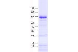 Validation with Western Blot (PATZ1 Protein (His tag))