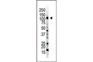Image no. 1 for anti-Ubiquitin-Like Modifier Activating Enzyme 1 (UBA1) (C-Term) antibody (ABIN357486) (UBA1 抗体  (C-Term))