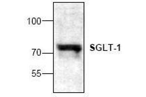 Image no. 1 for anti-Solute Carrier Family 5 (Sodium/glucose Cotransporter), Member 1 (SLC5A1) antibody (ABIN127319) (SLC5A1 抗体)