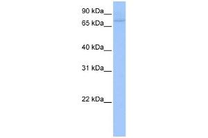 WB Suggested Anti-ZNF440 Antibody Titration:  0. (ZNF440 抗体  (C-Term))