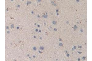 Detection of MAPKAPK2 in Human Cerebrum Tissue using Polyclonal Antibody to MAP Kinase Activated Protein Kinase 2 (MAPKAPK2) (MAPKAP Kinase 2 抗体  (AA 139-367))