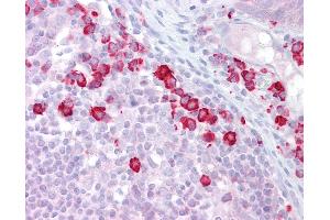Anti-DAK antibody IHC of human tonsil. (DAK 抗体  (N-Term))