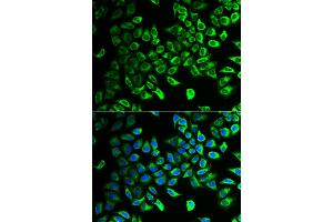 Immunofluorescence analysis of HeLa cells using DDAH2 antibody. (DDAH2 抗体)