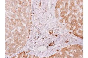 Immunohistochemistry (IHC) image for anti-Protein Kinase C Substrate 80K-H (PRKCSH) antibody (ABIN2855219)