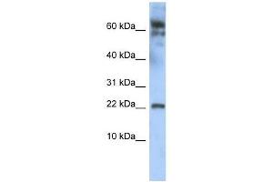 LDOC1 antibody used at 0. (LDOC1 抗体  (N-Term))