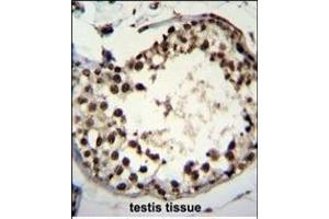 Immunohistochemistry (Paraffin-embedded Sections) (IHC (p)) image for anti-Additional Sex Combs Like 1 (ASXL1) (AA 521-549) antibody (ABIN655084)