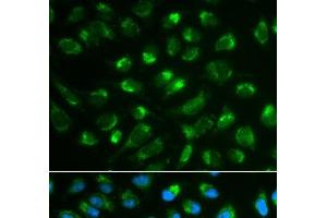 Immunofluorescence analysis of MCF-7 cells using IL7 Polyclonal Antibody (IL-7 抗体)