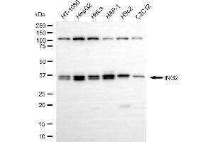 anti-Inhibitor of Growth Family, Member 2 (ING2) antibody