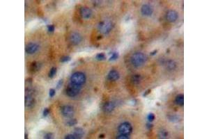 IHC-P analysis of Liver tissue, with DAB staining. (GLN1 抗体  (AA 1-373))