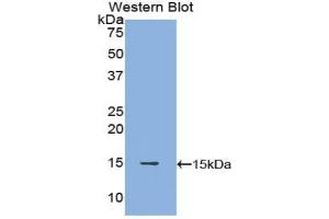 Detection of Recombinant POTEJ, Human using Polyclonal Antibody to POTE Ankyrin Domain Family, Member J (POTEJ) (POTEJ 抗体  (AA 109-269))