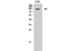Western Blotting (WB) image for anti-PR (Thr231) antibody (ABIN3177000) (PR (Thr231) 抗体)