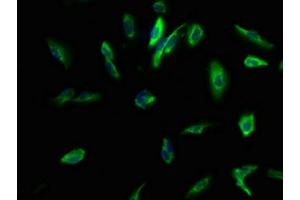 Immunofluorescence (IF) image for anti-Potassium Large Conductance Calcium-Activated Channel, Subfamily M beta Member 3 (KCNMB3) (AA 82-207) antibody (ABIN7146342)