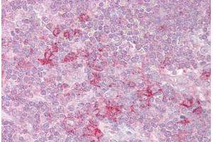 Anti-MST4 antibody IHC staining of human thymus. (STK26/MST4 抗体  (AA 340-354))