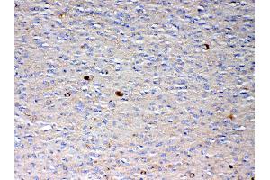 IHC analysis of NSF using anti-NSF antibody . (NSF 抗体  (AA 620-744))