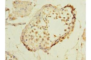 Immunohistochemistry of paraffin-embedded human testis tissue using ABIN7159074 at dilution of 1:100 (MXD3 抗体  (AA 1-206))