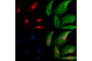 ABIN6259580 and ABIN6273739 staining  cells by IF/ICC. (PROP1 抗体  (Internal Region))