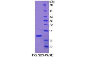 SDS-PAGE analysis of Mouse PDGFC Protein. (PDGFC 蛋白)