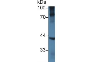 Detection of NKX6-1 in Human BXPC3 cell lysate using Polyclonal Antibody to NK6 Homeobox Protein 1 (NKX6-1) (NKX6-1 抗体  (AA 1-367))