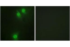 Immunofluorescence analysis of HeLa cells, using NEK9 (Phospho-Thr210) Antibody. (NEK9 抗体  (pThr210))