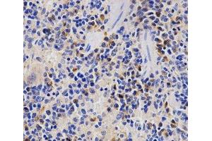 Immunohistochemistry of paraffin-embedded Rat spleen using PSMD3 Polyclonal Antibody at dilution of 1:200 (40x lens). (PSMD3 抗体)