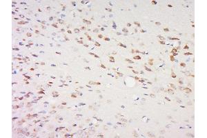 Immunohistochemistry (Paraffin-embedded Sections) (IHC (p)) image for anti-Sparc/osteonectin, Cwcv and Kazal-Like Domains Proteoglycan (Testican) 2 (SPOCK2) (AA 61-160) antibody (ABIN1386637)