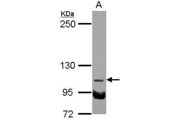 NDST3 antibody  (Center)