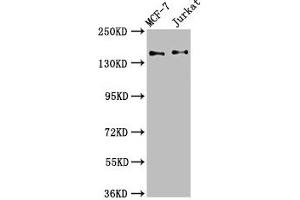 Western Blot Positive WB detected in: MCF-7 whole cell lysate, Jurkat whole cell lysate All lanes: KTN1 antibody at 3. (KTN1 抗体  (AA 978-1116))