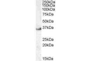 Image no. 1 for anti-LIM and SH3 Protein 1 (LASP1) (Internal Region) antibody (ABIN374893) (LASP1 抗体  (Internal Region))