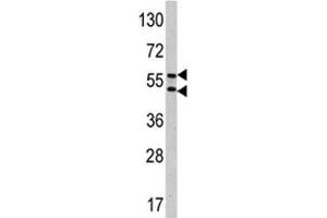 Western Blotting (WB) image for anti-Carbonic Anhydrase IX (CA9) (AA 113-143) antibody (ABIN3028531)
