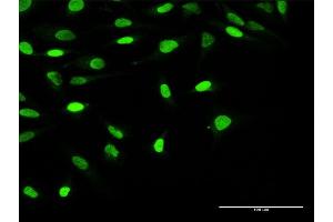 Immunofluorescence of purified MaxPab antibody to OBFC1 on HeLa cell. (OBFC1 抗体  (AA 1-368))