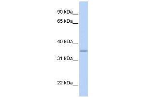 WB Suggested Anti-GRHPR Antibody Titration: 0. (GRHPR 抗体  (N-Term))