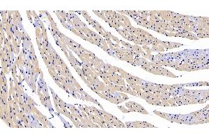 Detection of CTGF in Rat Cardiac Muscle Tissue using Polyclonal Antibody to Connective Tissue Growth Factor (CTGF) (CTGF 抗体  (AA 118-388))