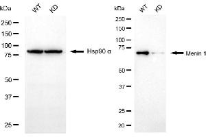 Western blotting analysis using menin 1 antibody (ABIN7799493). (Recombinant Menin 抗体)