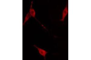Immunofluorescence (fixed cells) (IF/ICC) image for anti-Neurotrophic Tyrosine Kinase, Receptor, Type 2 (NTRK2) (pTyr516) antibody (ABIN6255941)