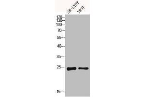 Western blot analysis of SH-SY5Y 293T using Dectin-2 antibody. (C-Type Lectin Domain Family 6, Member A (CLEC6A) (Internal Region) 抗体)