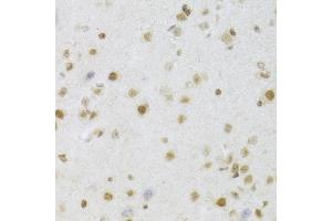 Immunohistochemistry of paraffin-embedded mouse brain using MCM4 Antibody (ABIN5971548) at dilution of 1/100 (40x lens). (MCM4 抗体)