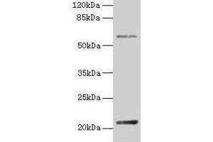 Western blot All lanes: DUSP13 antibody at 4 μg/mL + Hela whole cell lysate Secondary Goat polyclonal to rabbit IgG at 1/10000 dilution Predicted band size: 21, 23, 7, 28, 8, 10, 18 kDa Observed band size: 21 kDa (DUSP13 抗体  (AA 1-198))