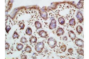 Formalin-fixed and paraffin embedded mouse intestine labeled with Rabbit Anti-Bim(Ser87) Polyclonal Antibody, Unconjugated  at 1:200 followed by conjugation to the secondary antibody and DAB staining (BIM 抗体  (pSer87))